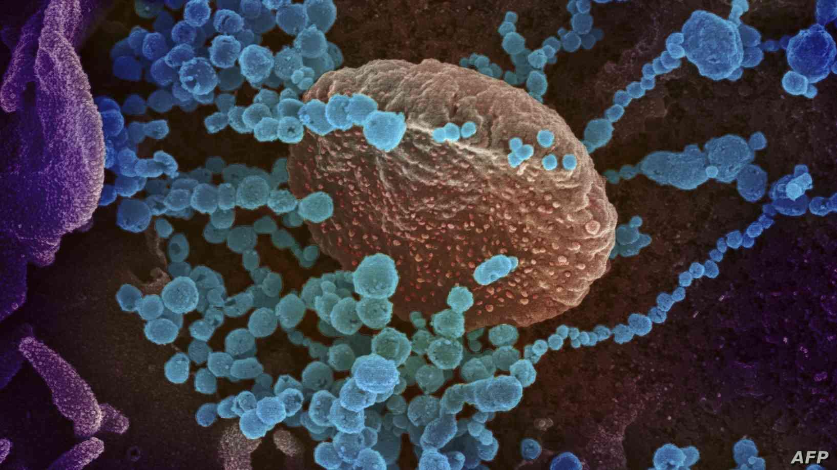 عالم أمريكي يكشف طريقة اجتثاث فيروس كورونا من جذوره
